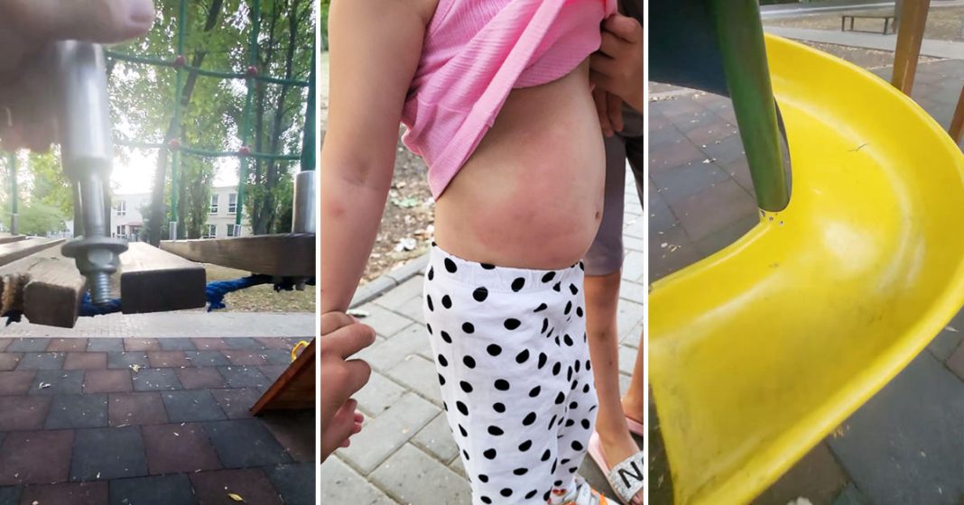 Травма у ребенка на детской площадке Кишинев