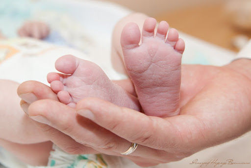 Женщине, родившей ребенка с двумя головами, сказали, что она ждет близнецов